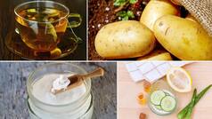 Dark Circles Remedies: 5 Easy And Natural Ways To Get Better Looking Eyes