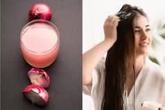 7 Effective Uses of Onion Juice to Combat Excessive Hair Loss