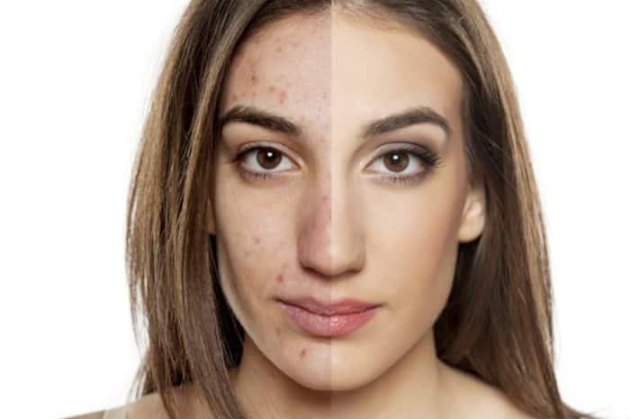Cell Phone Rash Are You Addicted to Your Smartphone? Be Ready For Its Skin Hazards