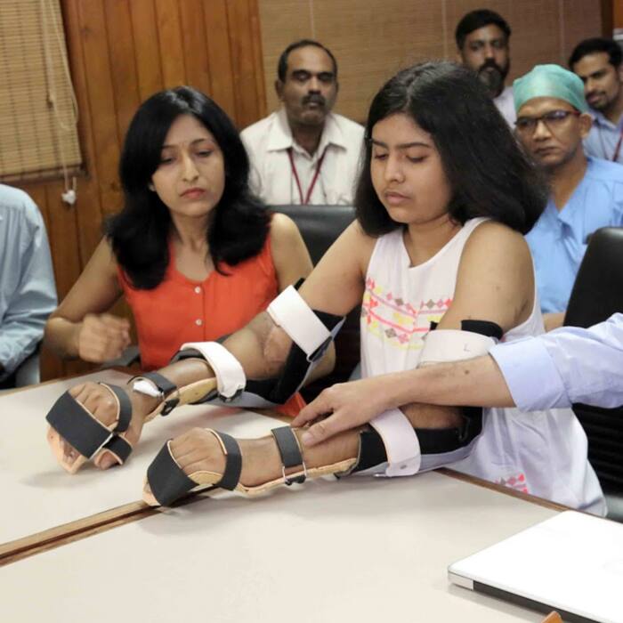 Asia's first upper arm double hand transplant was done in Kerala