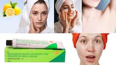 Skincare Tips: Stop Believing These 6 Skincare Hacks Right Away!