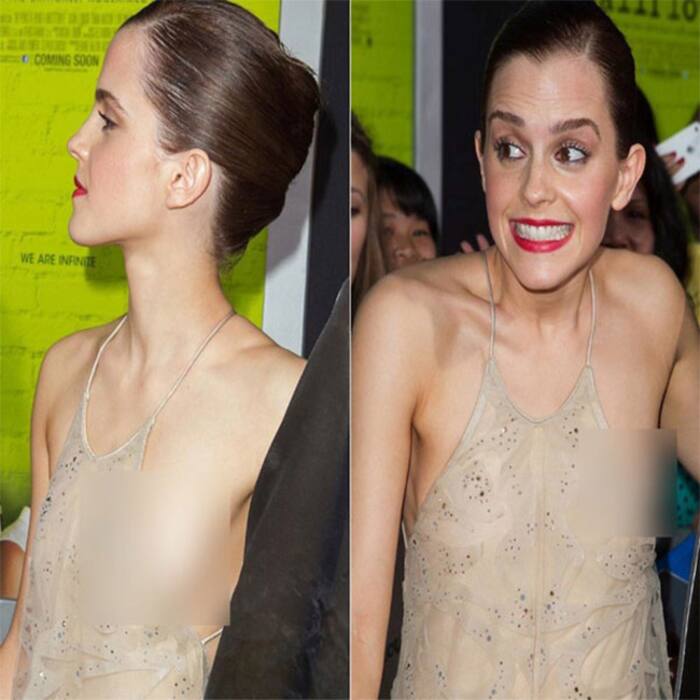 Emma Watson   s wardrobe malfunction during The Perks of Being a Wallflower premiere