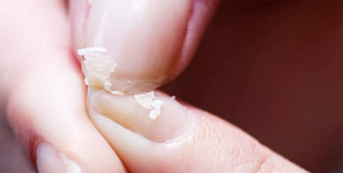 Improves Nail Health