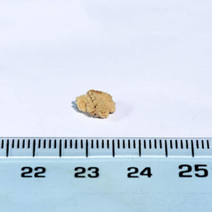 Benefits of including Khus Khus in your diet