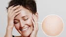 Do You Have Oily Skin? Eat These Foods to Deal With it
