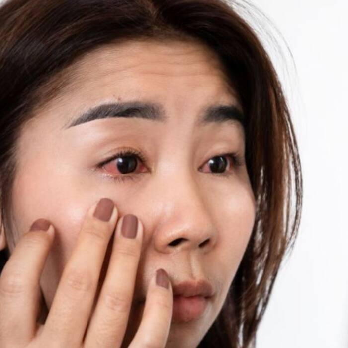 Redness and irritation