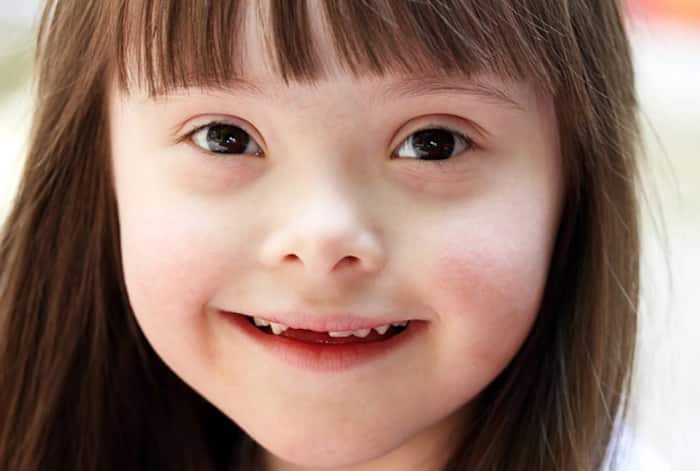 Strengths of Down Syndrome patients