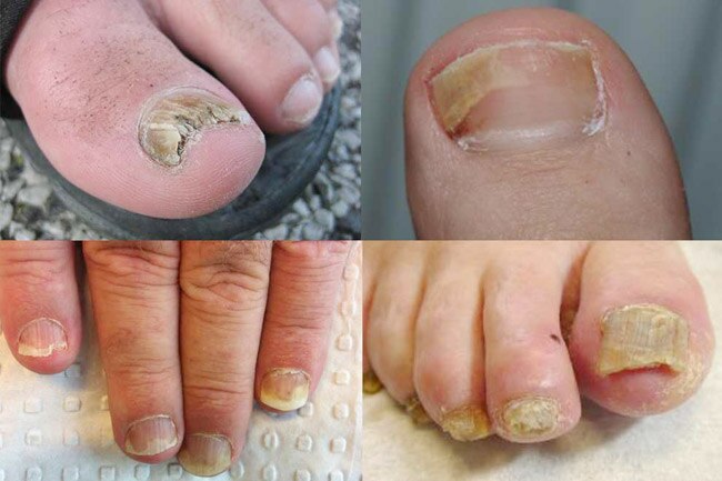 Treat Skin Conditions