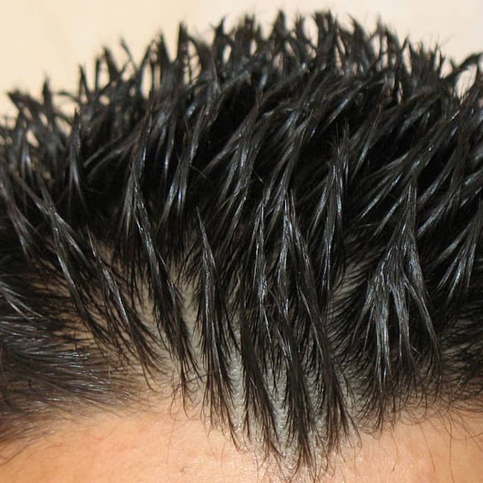 Here are 5 hair products that are making you bald