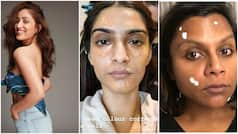 From Mindy Kaling to Yami Gautam, 5 Celebrities Who Are Vocal About Their Skin Issues